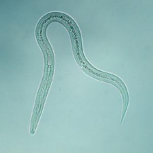 spoelwormen.jpg